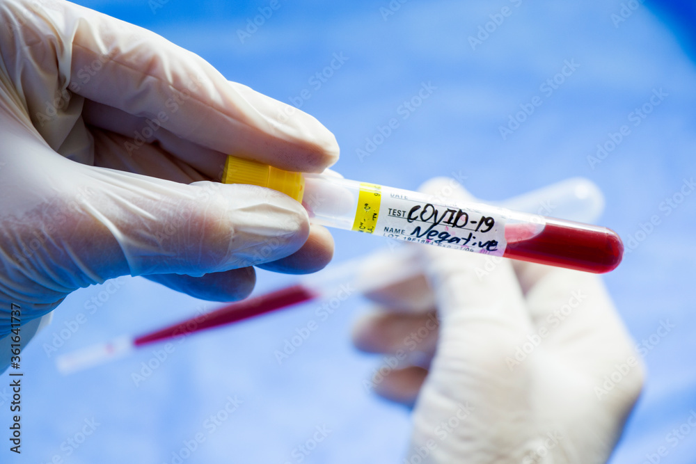 Corona virus negative test samples. Diagnosis and laboratory. Studio shoot, white background. Corona virus negative test samples. Diagnosis and laboratory. Studio shoot, white background.