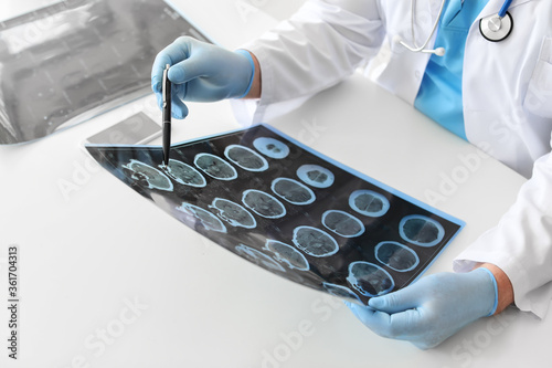 Senior neurologist with MRI...