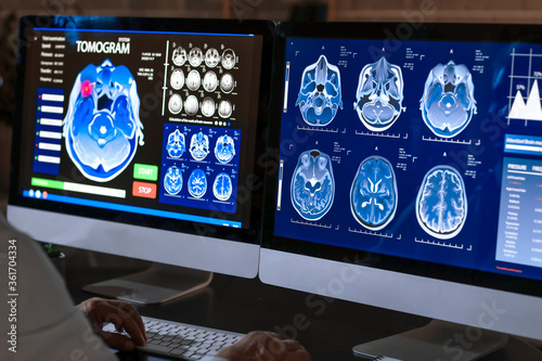 Male neurologist with MRI s...