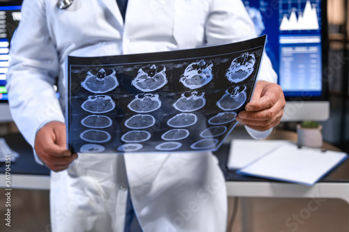 Senior neurologist with MRI...