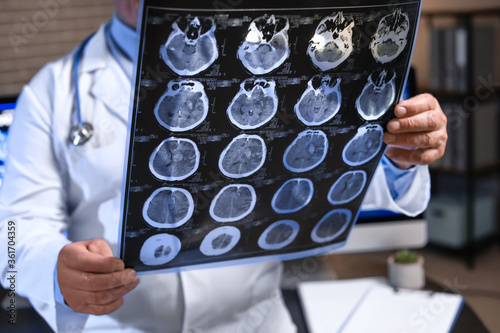 Senior neurologist with MRI...