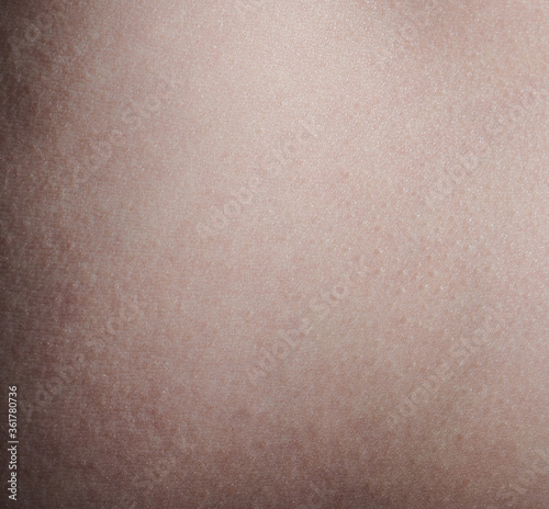 Surface of human skin background