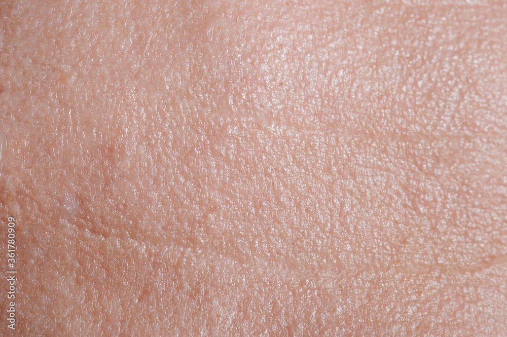 Fototapeta premium Skin on forehead with wrinkles