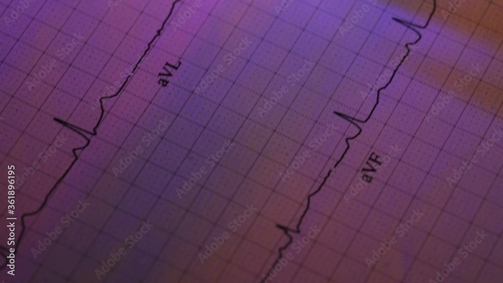 ECG heart monitor readout and a syringe ECG heart monitor readout and a syringe