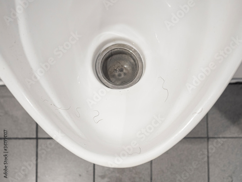 White ceramic urinal chamber pot with male public hair. Male hair lost problem.