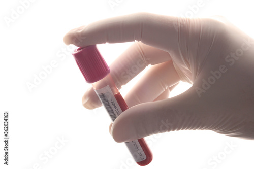 Mão com luvas de borracha segurando um tubo de ensaio com amostra de sangue. photo
