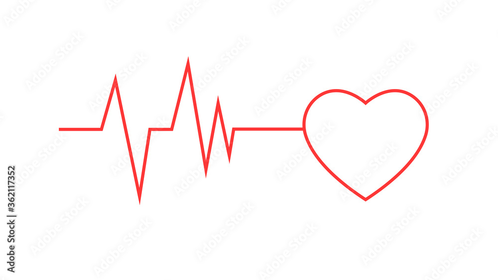 electrocardiogram graphic in quality