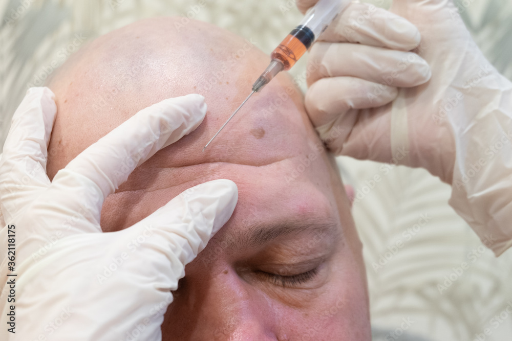 men's cosmetic operations. injections in the forehead to straighten out wrinkles, Botox men's cosmetic operations. injections in the forehead to straighten out wrinkles, Botox