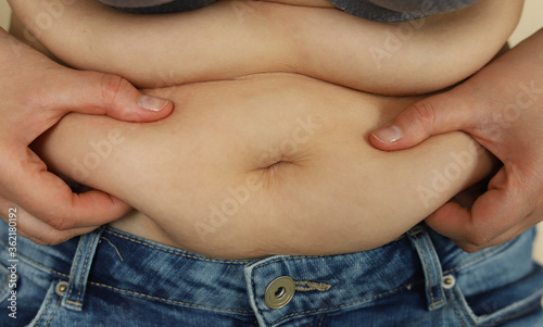 A Caucasian woman holds extra fat on her stomach with her hands. Selective focus. Obesity. Excess weight.