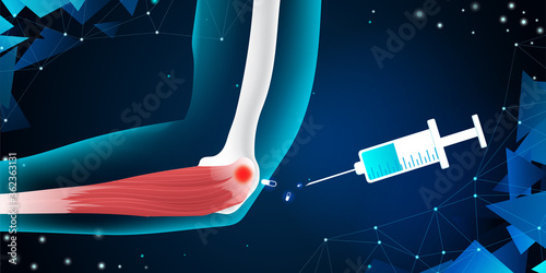 New technology for elbow bone injury. Abstract traumatology and orthopedics. Medical, science, and technology in the hospital.