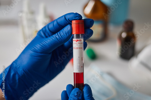Doctor scientist in protective gloves holding test tube with blood for 2019-nCoV analyzing.Blood Sample. Corona virus outbreaking. Epidemic virus