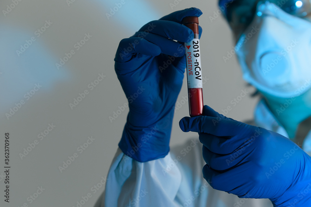 Coronavirus 2019-nCoV Blood Sample. Doctor scientist in protective gloves, mask and glasses holding test tube with blood for 2019-nCoV analyzing. Coronavirus blood test Concept. Vaccine research Coronavirus 2019-nCoV Blood Sample. Doctor scientist in protective gloves, mask and glasses holding test tube with blood for 2019-nCoV analyzing. Coronavirus blood test Concept. Vaccine research