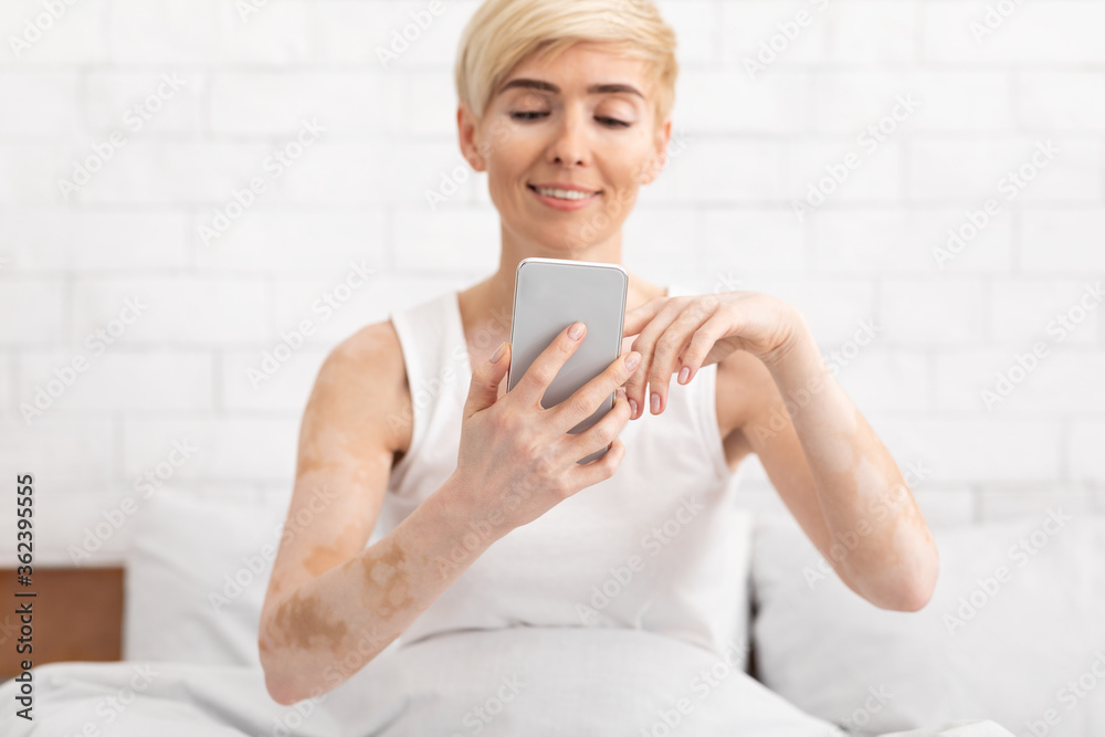 Mature woman with vitiligo networking on cellphone in bed Mature woman with vitiligo networking on cellphone in bed