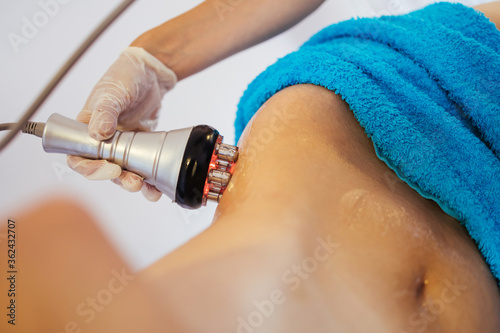 Canvas Print Cavitation RF body treatment and contemporary medicine for health beauty improve