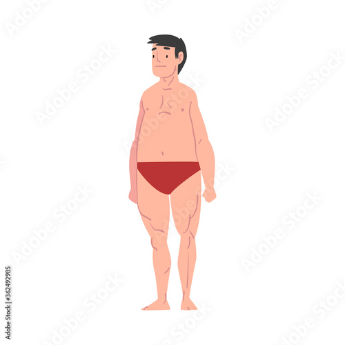 Overweight Man in Underwear, Male Body Type Cartoon Style Vector Illustration on White Background