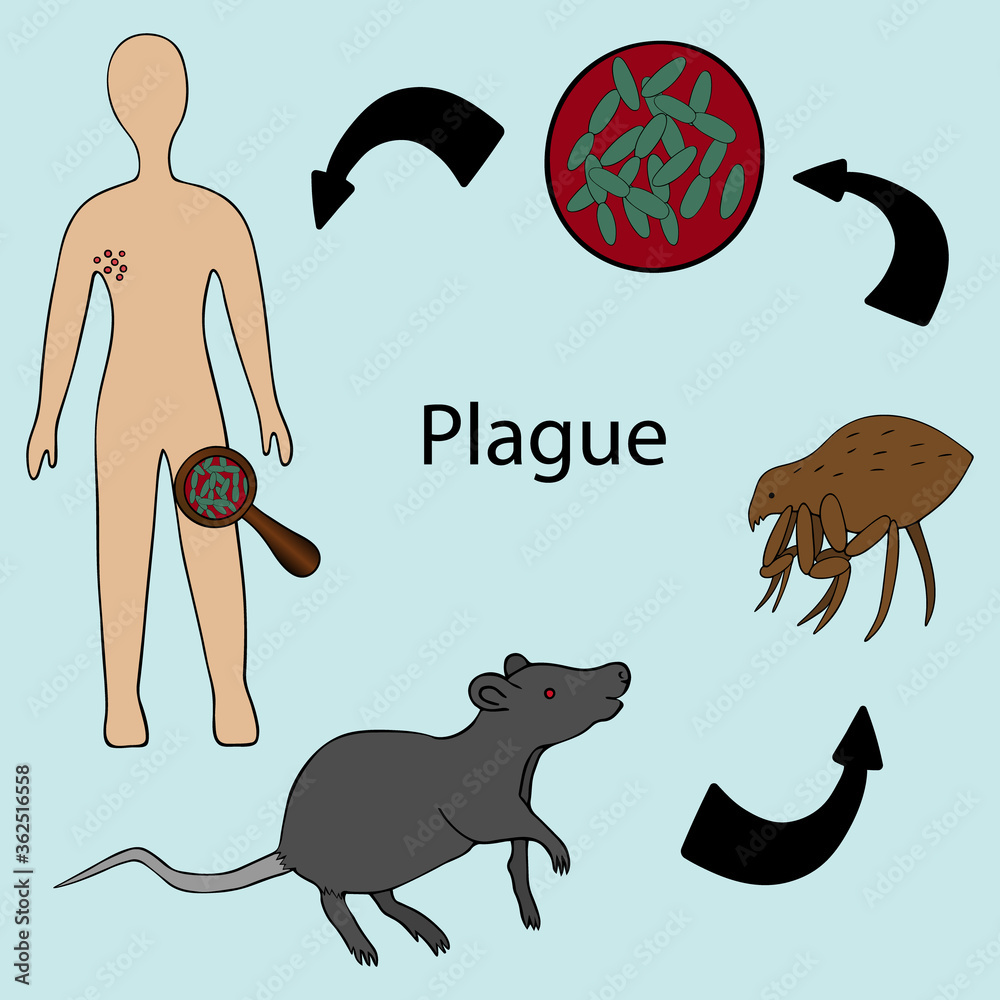 The scheme of infection with the plague bacterium: rat - flea - man ...