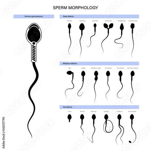 Reproductive system concept