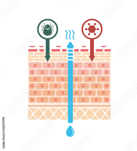 Sectional view of atopic dermatitis / vector illustration (no text)