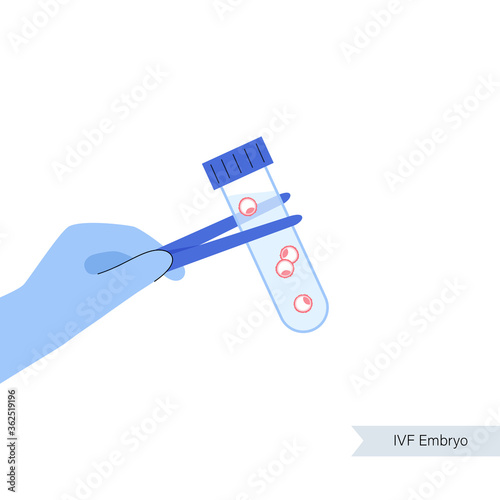 Reproductive system concept