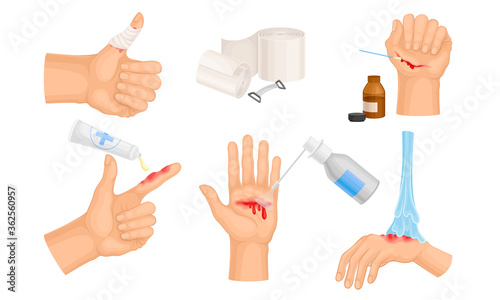 Hands with Injured Skin and Procedures of Bandaging and Wound Cleaning Vector Set