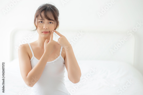 Beautiful portrait young asian woman with acne problem in the bedroom, trouble of beauty on face, zit treatment, asia girl is pimple having worry and displeased, skincare and healthy concept.