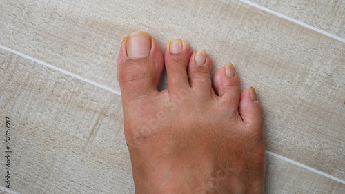 men 's foot and dirty long pedicure