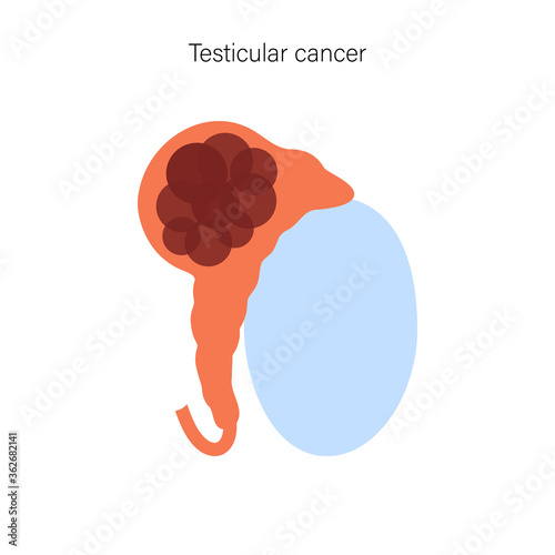 Reproductive system concept