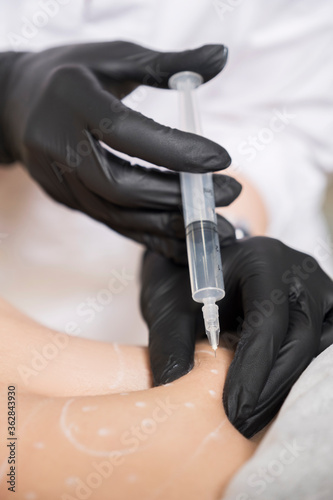 Cosmetologist doctor do lipolytic injection procedure to a woman in her clinic. She wear black glowes and mask and holds syringe with a needle photo