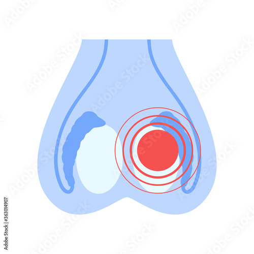 Reproductive system concept