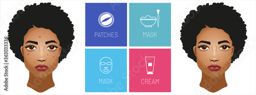 Girl with dark skin, skin care products.Treatment beauty. Problems on the skin pimples and acne, and dark circles under the eyes. Types of cosmetics masks, patches under the eyes and cream. 