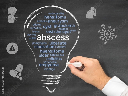 abscess