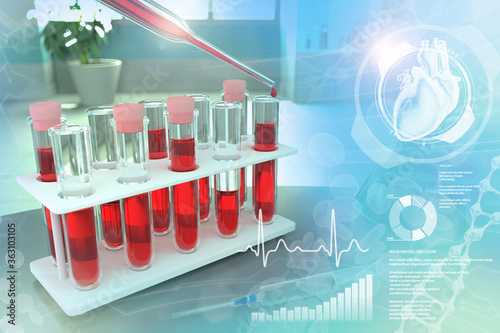 test tubes in medical facility - blood analysis for amount of platelets or phosphorus, medical 3D illustration with creative overlay photo