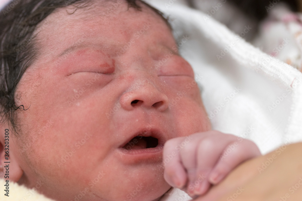 Obraz premium 泣き声をあげている出産直後の新生児