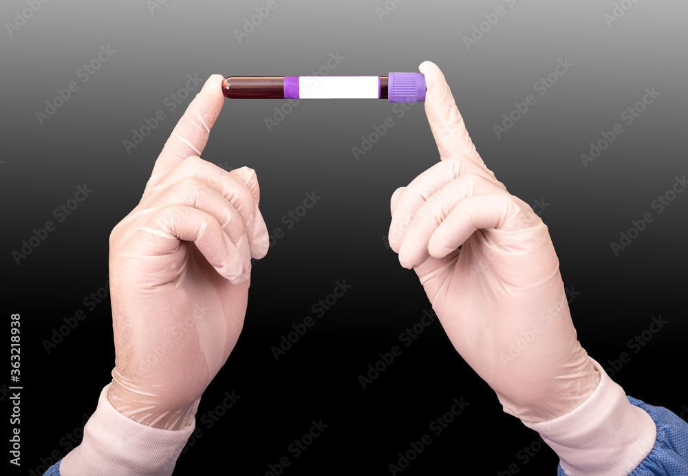 Blood test sample for presence detection of virus Covid-19 or Coronavirus in the hands of doctor on black and white background, space for text on the test tube label Blood test sample for presence detection of virus Covid-19 or Coronavirus in the hands of doctor on black and white background, space for text on the test tube label