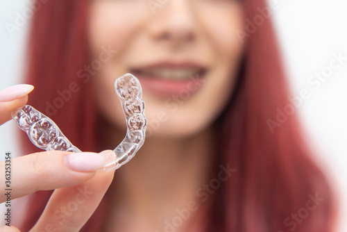 Woman with a beautiful smile shows a transparent mouth guard