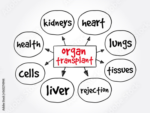 Organ Transplant mind map, medical concept for presentations and reports