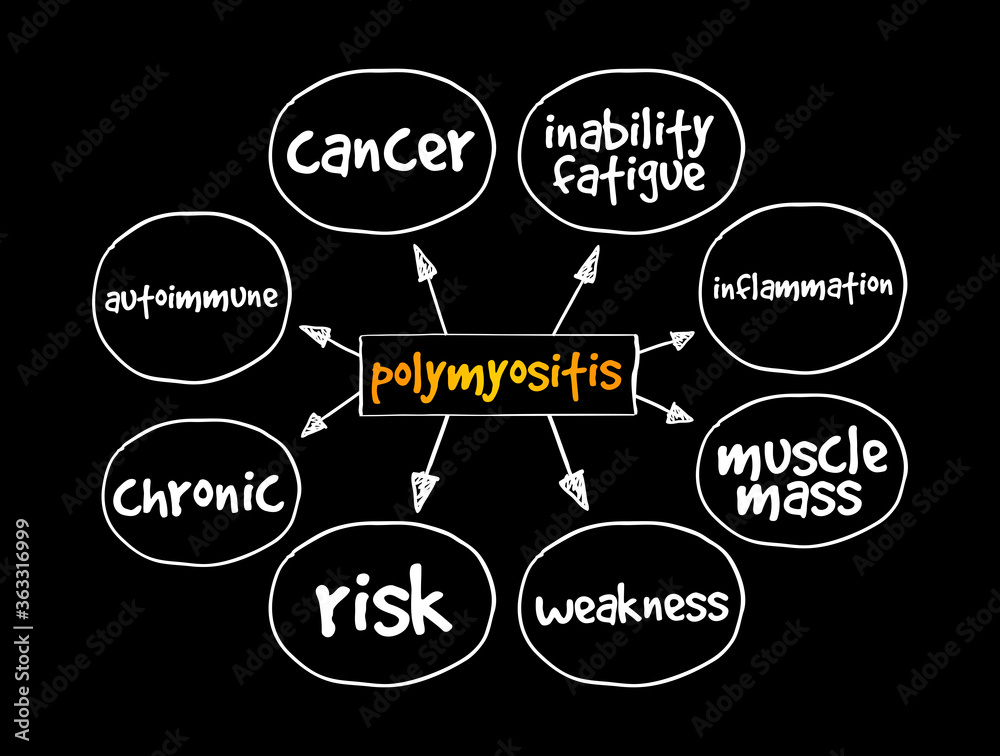 Polymyositis PM mind map, medical concept for presentations and reports Polymyositis PM mind map, medical concept for presentations and reports
