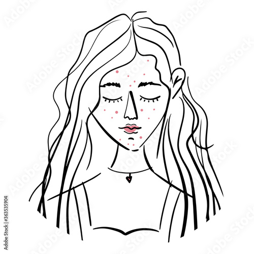 Acne, inflammation, eczema. Problem skin. Dermatology, cosmetology. Young girl with curly hair, puffy lips, decoration on her neck on white isolated background. Torso. Abstract sketch in black lines.