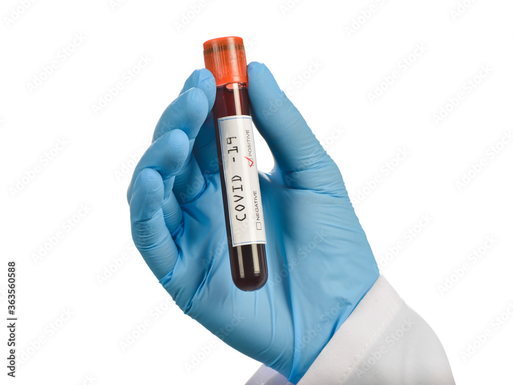 Obraz premium Blood sample tested COVID-19 positive on medical assistant's hand isolated on white background. 
