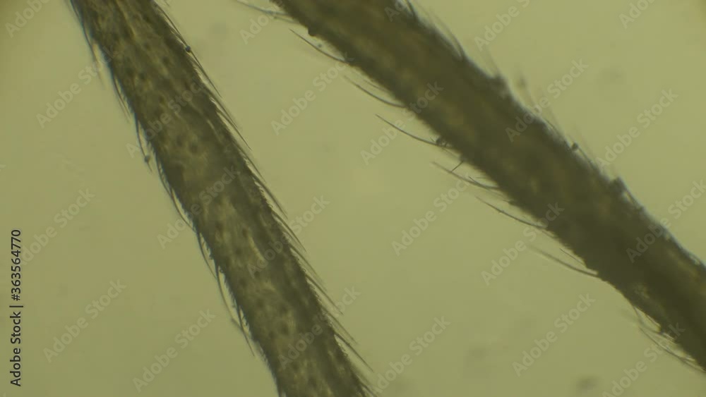 Microscope Insect Leg Microscopy of insect (small fruit flies) legs. Magnification 150x with ...