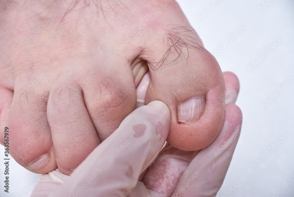 The doctorpodiatrist does an examination of the patient's foot in the
