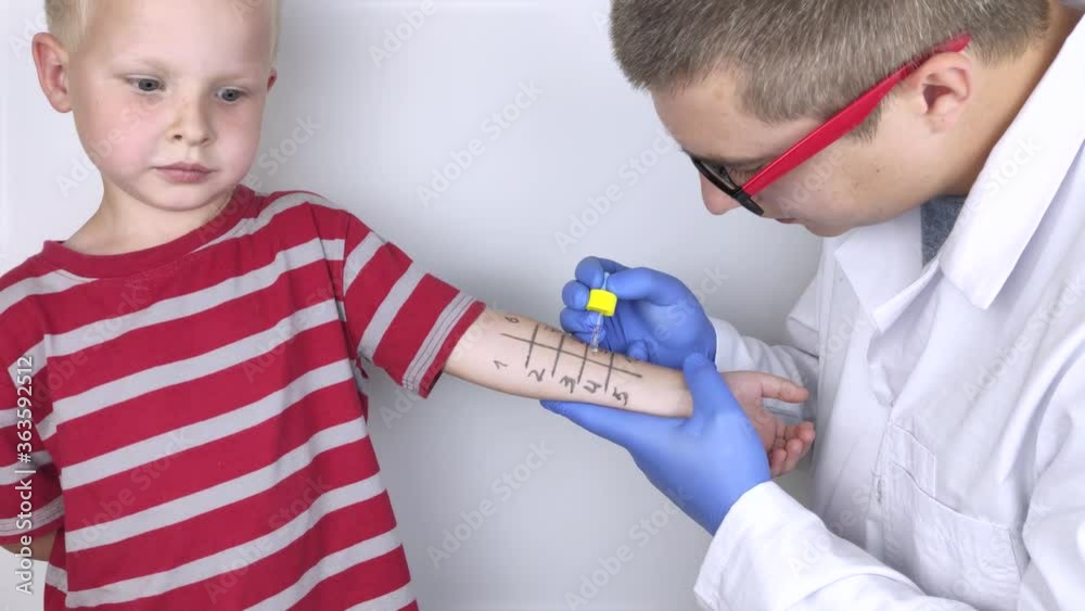 video-an-allergist-doctor-makes-a-skin-test-for-allergies-the-boy-is
