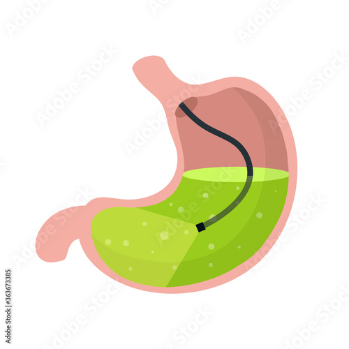 Gastroscopy. Endoscopy and digestive problems. Hose with camera. Procedure with internal organs. Cartoon flat illustration. Medical Visual inspection of stomach