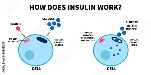 Flat vector illustration of importance of insulin. How does insulin work, educational medical visual diagram. Insulin unlocks glucose channel.