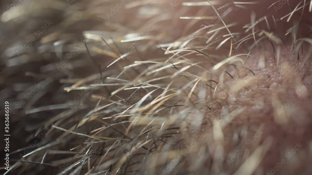 Macro Hair On Human Skin Macro Hair On Human Skin