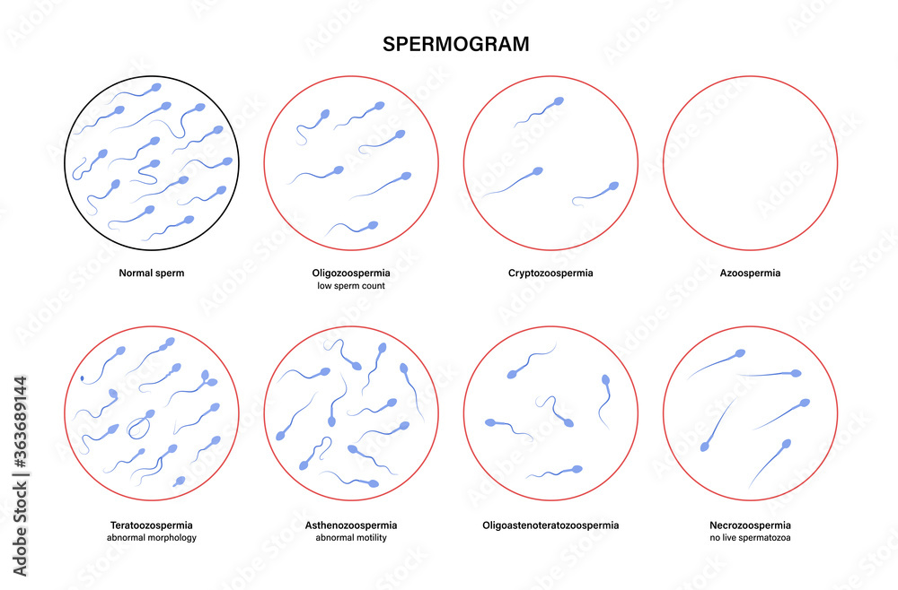 Reproductive system concept Stock Vector | Adobe Stock