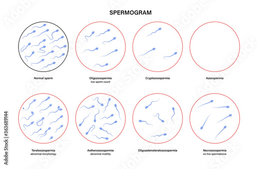 Reproductive system concept