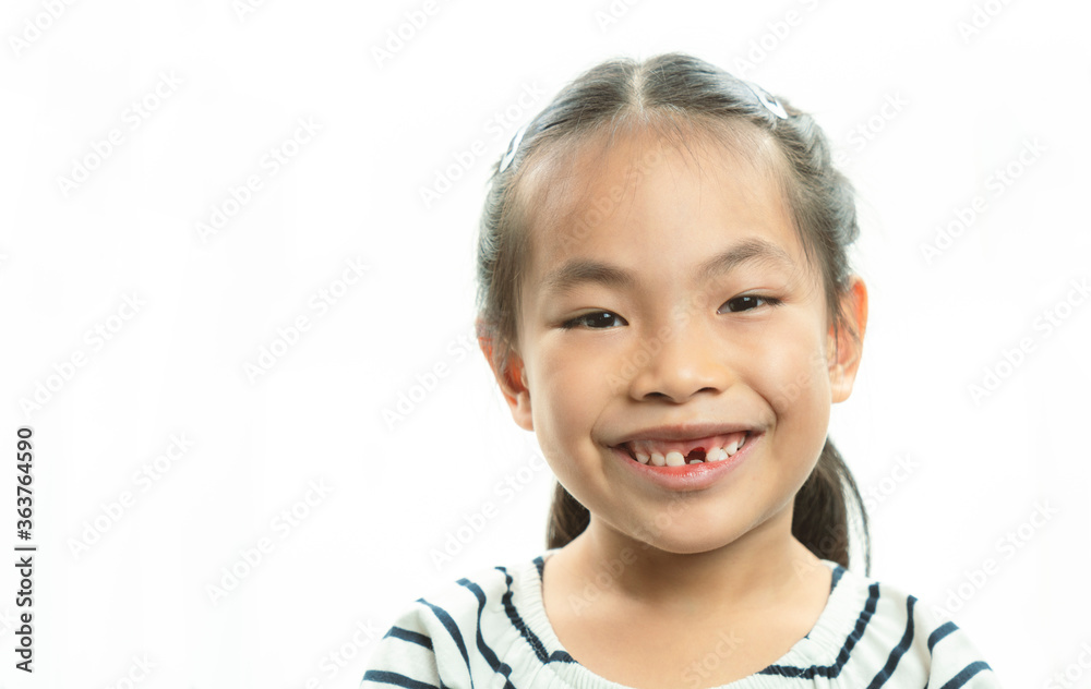 Adorable Asian little girl smiling and showing off her first lost milk tooth. Cute portrait Asian little girl after dropping her front milk tooth, fresh scars on gum at the recently toothed position.
