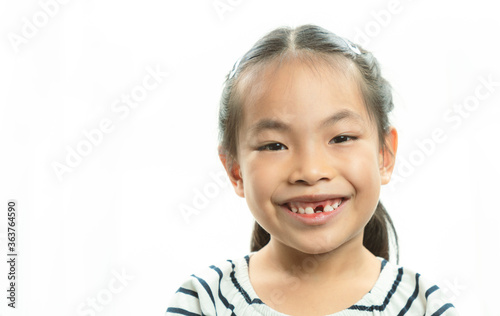 Adorable Asian little girl smiling and showing off her first lost milk tooth. Cute portrait Asian little girl after dropping her front milk tooth, fresh scars on gum at the recently toothed position.