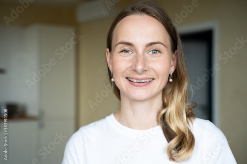 Braces on the teeth. The girl smiles showing her braces on her teeth. Free Download Braces on the teeth. The girl smiles showing her braces on her teeth. - GFXLoad